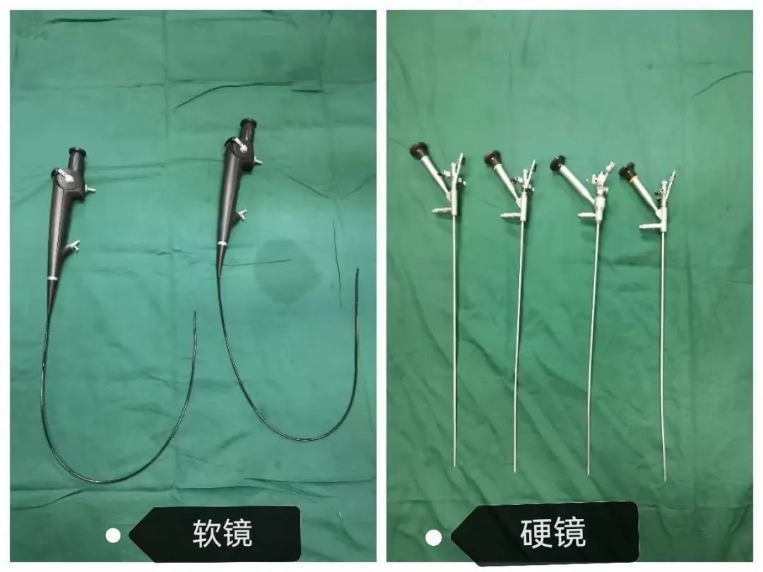 该技术采用直径约3毫米的电子软镜,经尿道自然腔道直达肾盂肾盏,镜体
