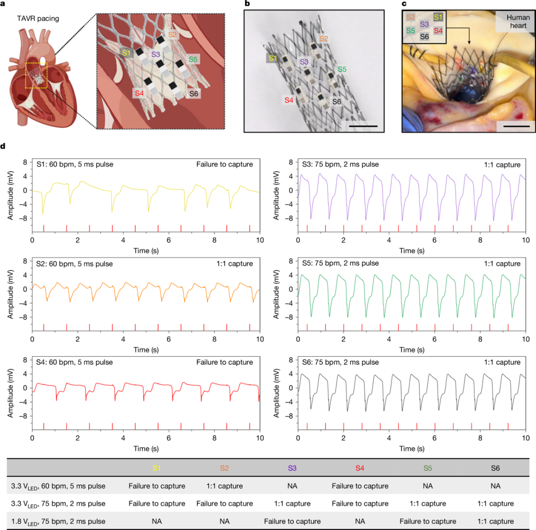 图丨体外演示将多台起搏器与 TAVR 瓣膜集成于人类心脏中进行心脏起搏（来源：Nature）