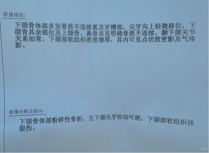李先生公开的影像会诊书