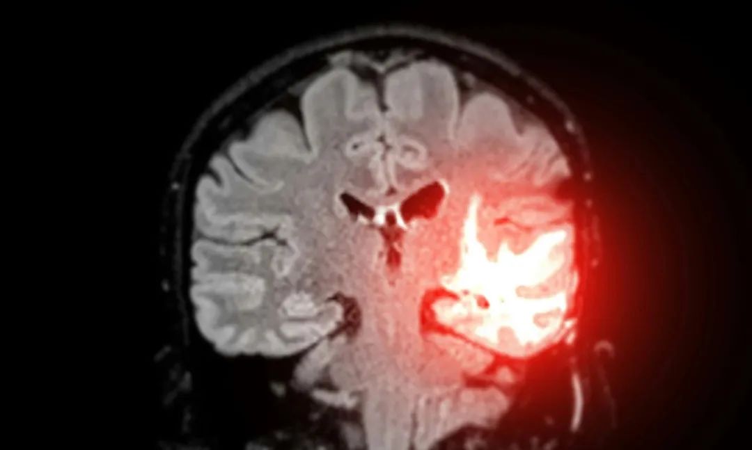 图片来源：Unsplash+