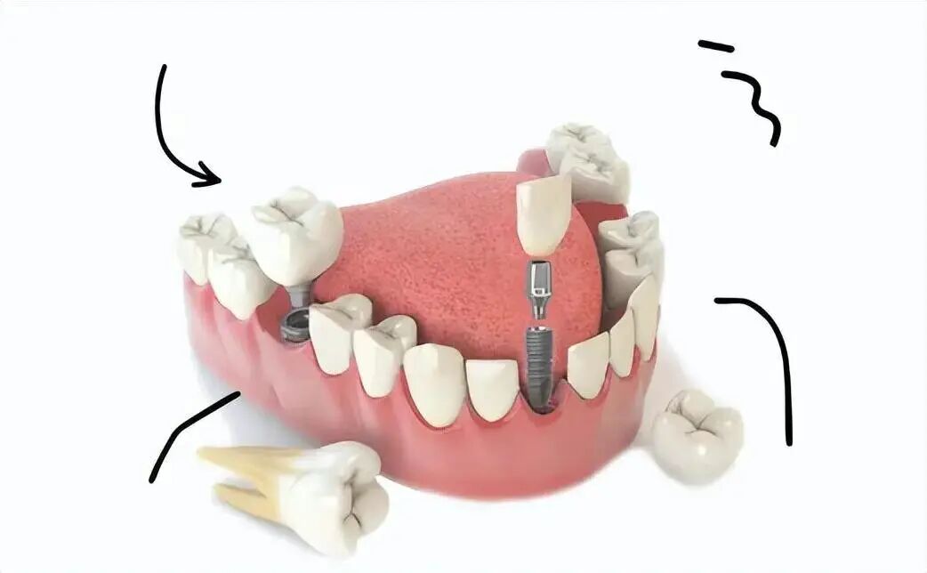 圖源：網(wǎng)絡(luò)