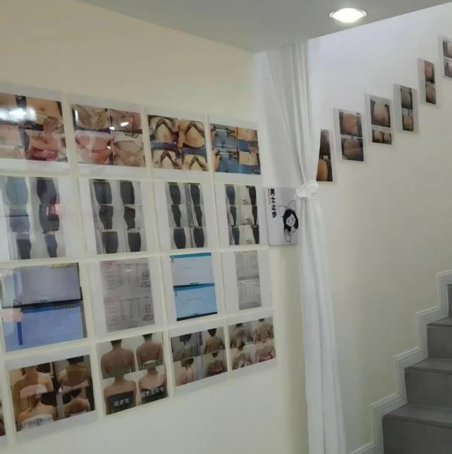 产后康复机构的墙上挂满案例