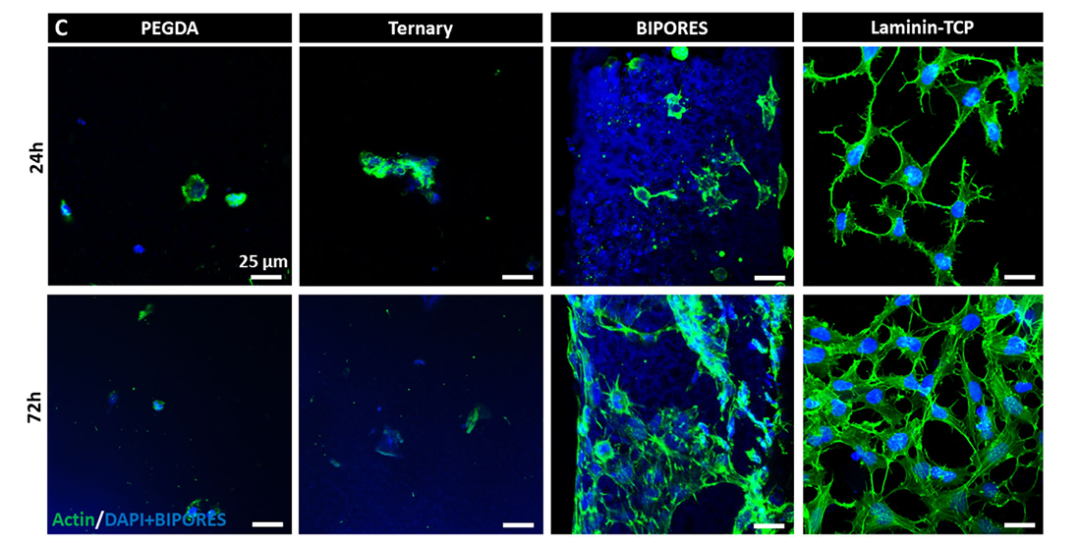 图 | 神经干细胞在支架上附着、铺展和生殖（荧光标记绿色为细胞骨架，蓝色为细胞核）（来源：团队论文）