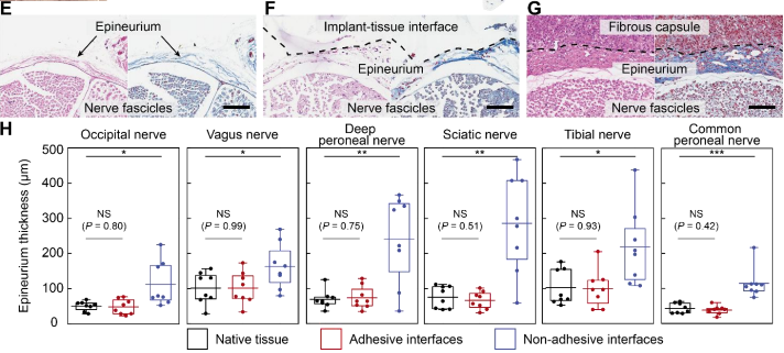 图丨非纤维化生物电子界面的验证（来源：Science Advances）
