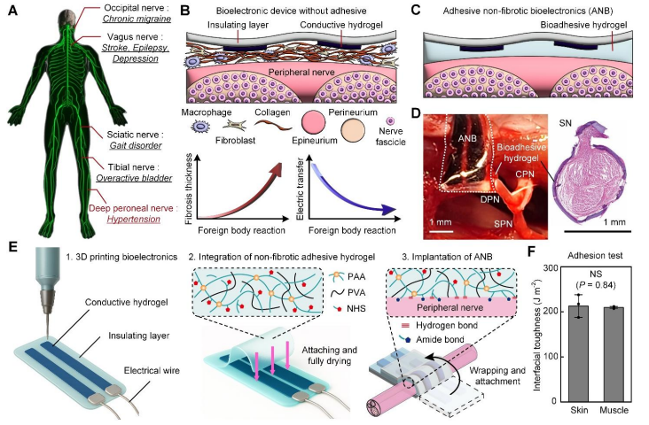 图丨ANB 作为非纤维化界面策略的设计与机制（来源：Science Advances）