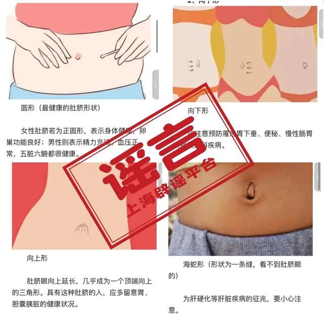 为什么用特殊脐带夹看肚脐形状就能知道身体好不好，是真的吗？_https://www.jmylbn.com_新闻资讯_第2张