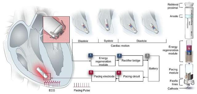 共生型自供電無導(dǎo)線心臟起搏器示意圖。中國科學(xué)院大學(xué)供圖