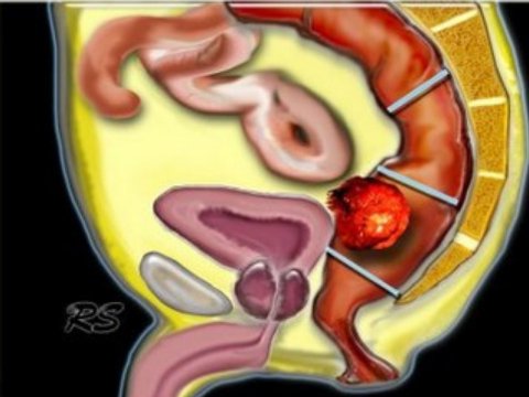 你在治疗的时候病人有可能拉到你的治疗床上