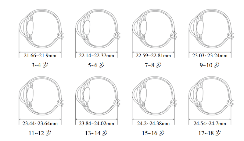 儿童眼轴正常发育值示意图。《愿你眼明心亮：全家人都需要的护眼指南》插图