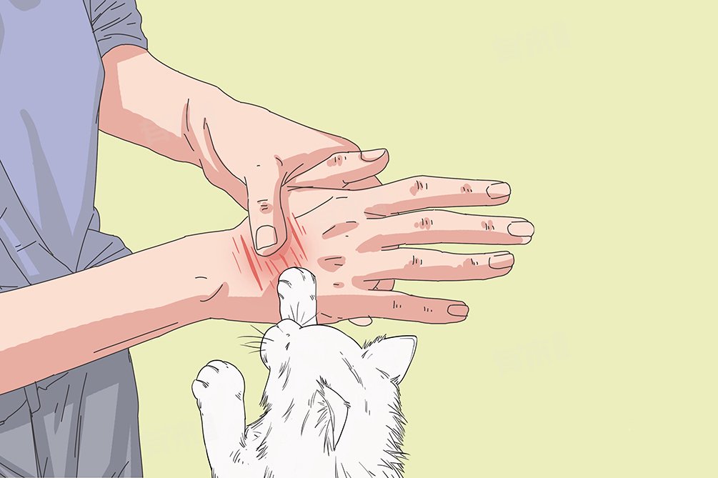 被猫抓了看什么科室|感染|急诊科|皮肤科|猫抓病|伤口_新浪新闻