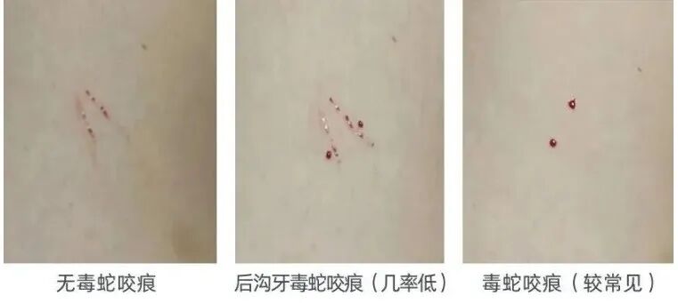 一女子被毒蛇咬伤！气温回升，重要提醒_新浪财经_新浪网