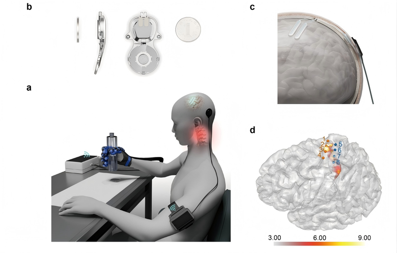 获批上市的首款侵入式脑机接口医疗器械示意图。受访者供图