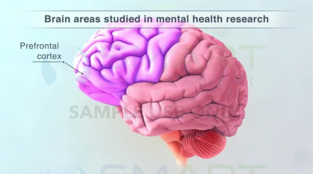 紫色区域为前额叶皮层，图源SMART Imagebase