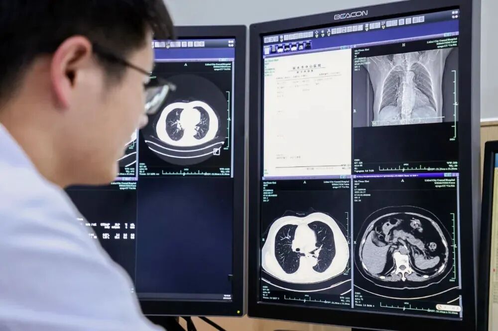 阿里巴巴达摩院医疗