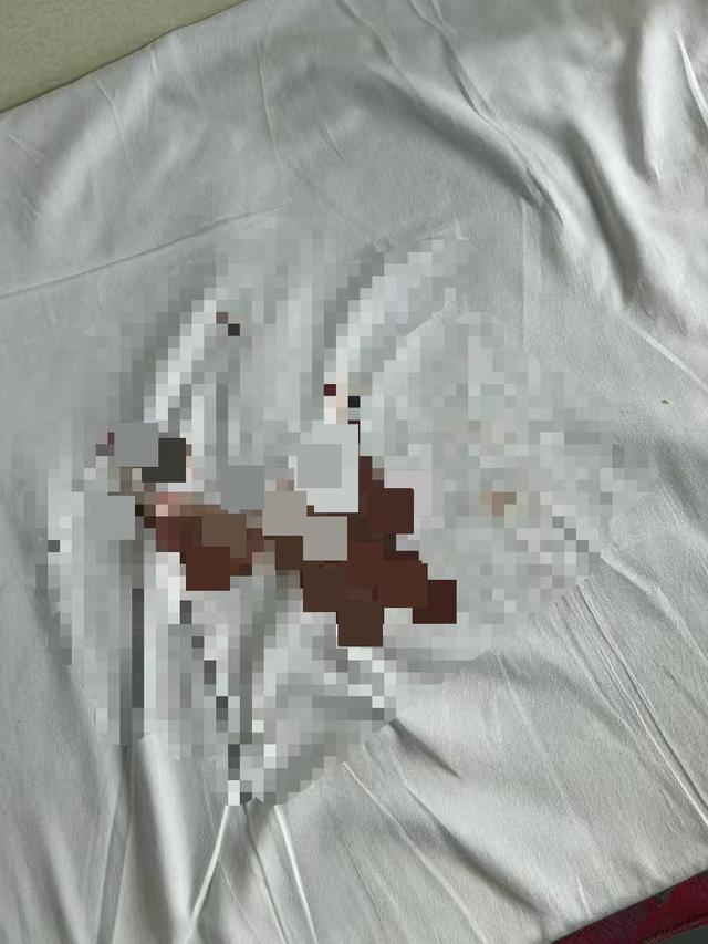 张女士不慎弄脏床单（受访者供图）