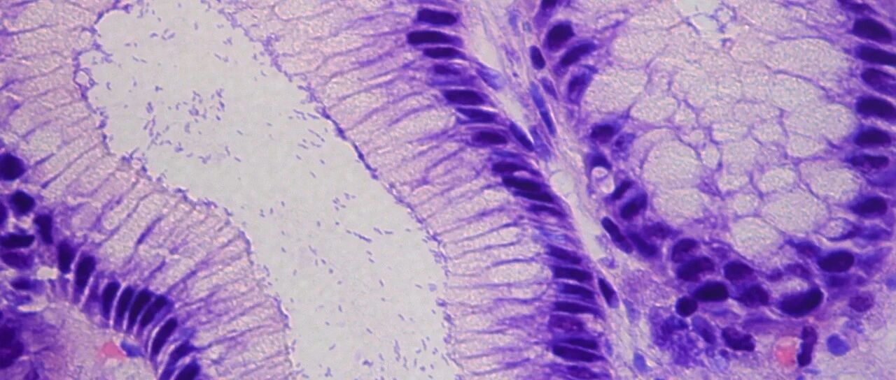 药效飙升60倍！科学家改造“老药”甲硝唑，可低剂量根治幽门螺杆菌