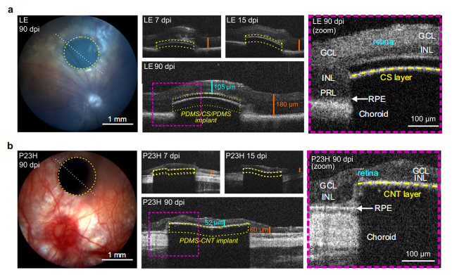 图丨体内光声植入物生物相容性研究（来源：Nature Communications）