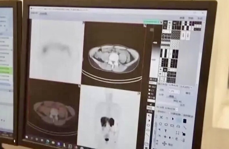 国内核药赛道大爆发！百万元治疗费用有望大幅下降