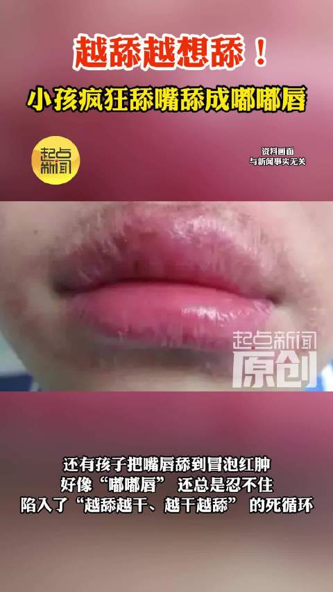 越舔越想舔！小孩疯狂舔嘴舔成嘟嘟唇