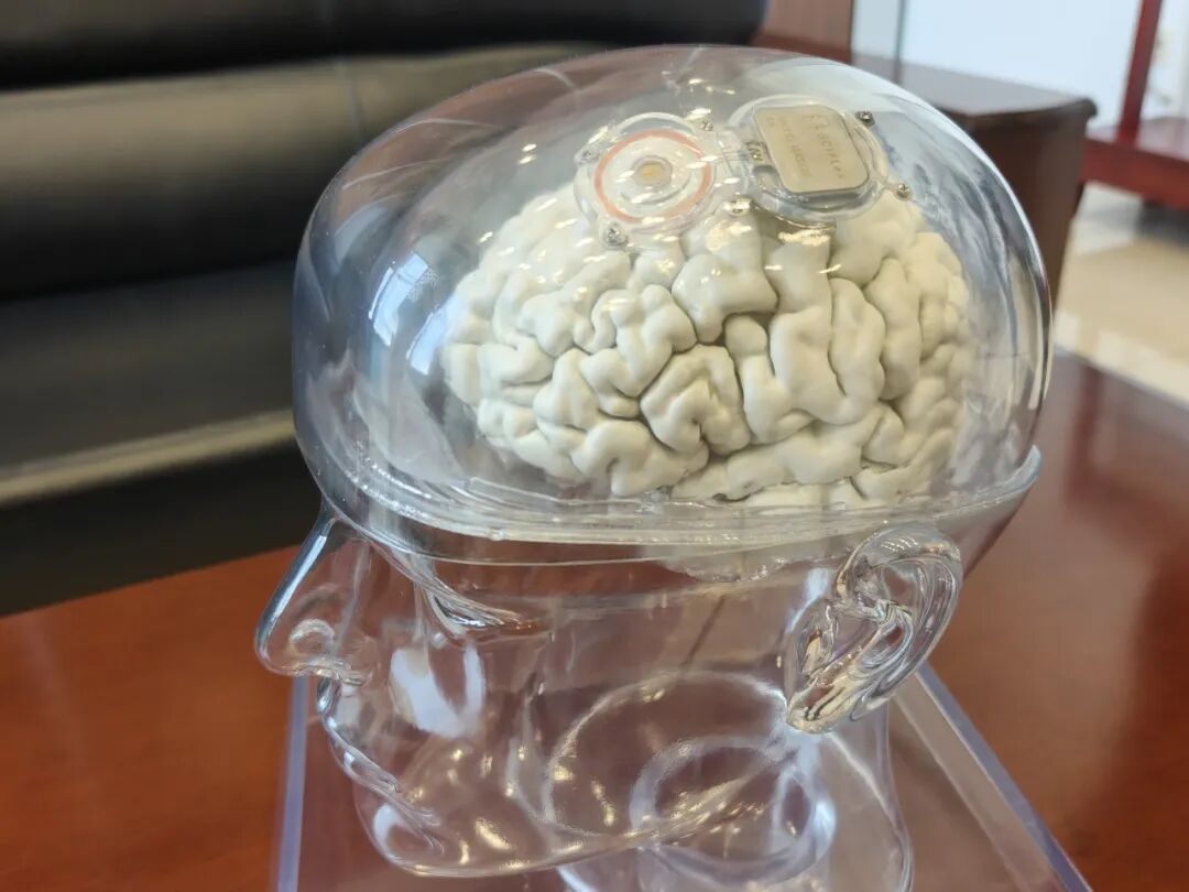 超百通道侵入式脑机接口系统。科技日报记者 于紫月 摄