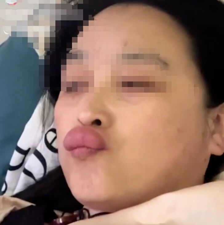 姥姥亲吻婴儿脚丫后，嘴唇红肿如香肠！医生提醒......