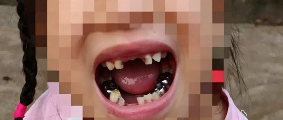 宇树机器人踢掉女孩牙齿 涉事方回应