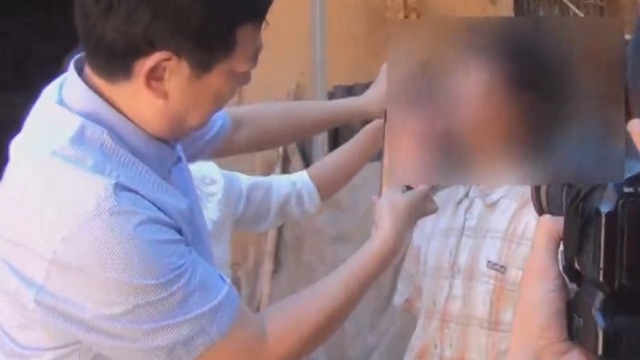 聋哑男子身患怪病 鼻子不断变长如同象鼻