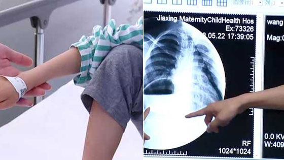 7岁男孩骨瘦如柴仅30斤 医生检查吓坏了>>