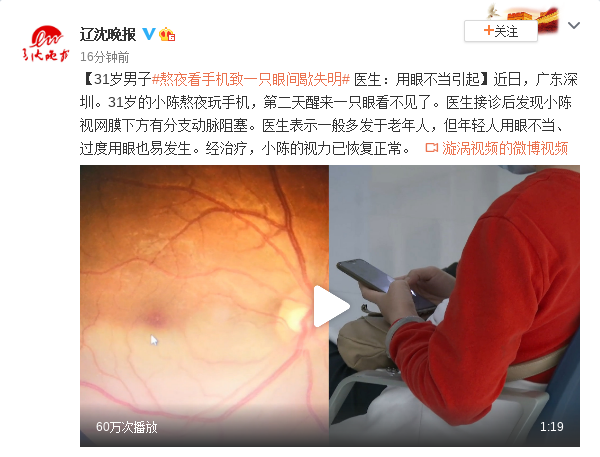 31岁男子熬夜看手机致一只眼间歇失明