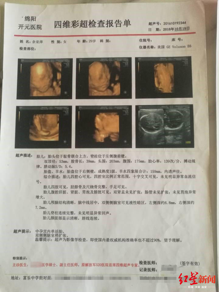 检查,她提供的报告中,其中一项超声描述中有一条显示:胎儿四肢可见,胫