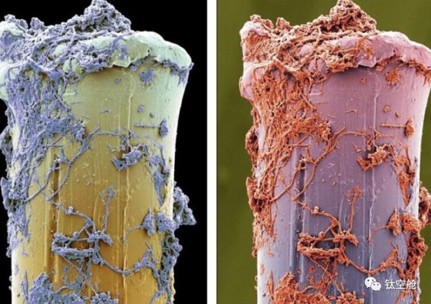 ▼在电子显微镜下,附着在废旧牙刷毛上的牙菌斑.