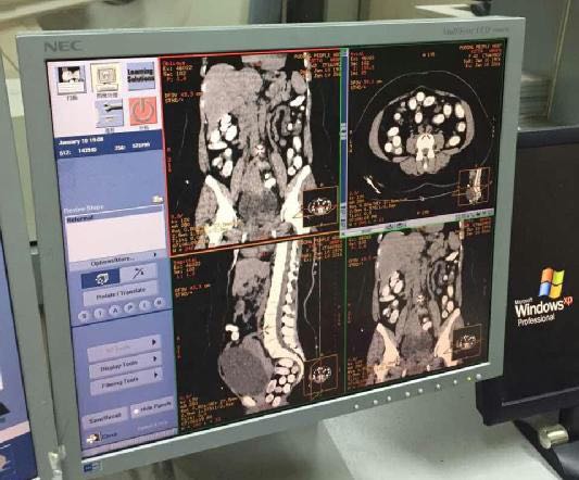 上海海关连续在浦东机场旅检渠道查获香港籍犯罪嫌疑人走私毒品可卡因