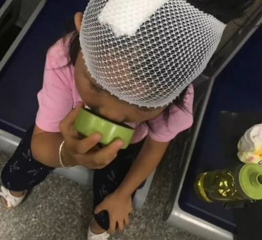 6岁女童被高空坠物砸破头警方采录全楼住户指纹