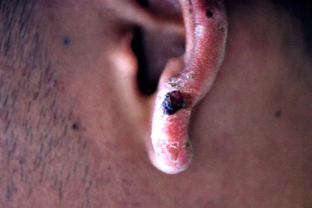 西藏边防官兵的耳朵.宋小理摄