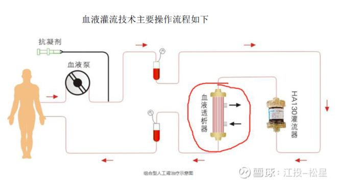 医疗耗材超标怎么分析健帆生物投资价值分析报告（雪球首发详细版）白马？黑马？_https://www.jmylbn.com_新闻资讯_第12张