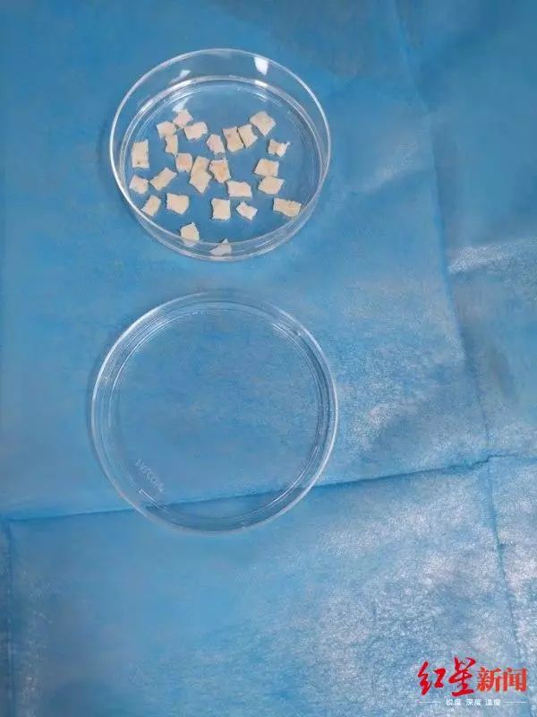 ↑经过剪裁后的卵巢组织皮质片