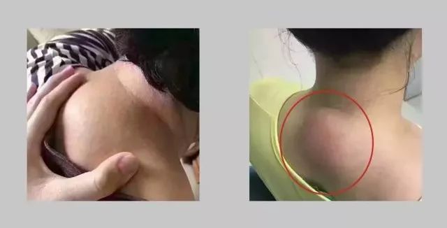 乌龟脖高低肩拧成麻花的脊柱看着都疼暴露年龄的细节90的人都不注意