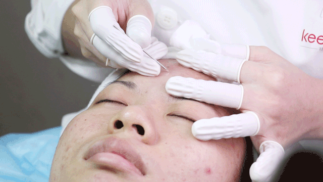 1的皮肤管理工作室,女神们扎堆来!|皮肤管理|祛痘_新浪新闻