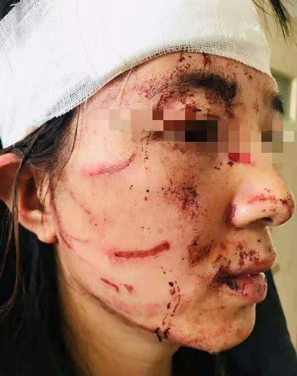 温州一女子被怀疑出轨 在路口遭公公和丈夫暴打