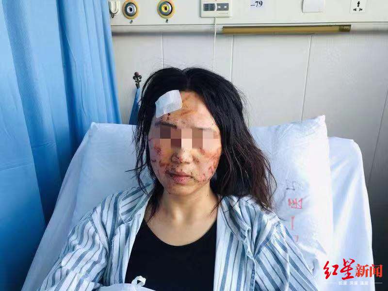 温州女子被公公丈夫暴打毁容涂大便 警方立案侦
