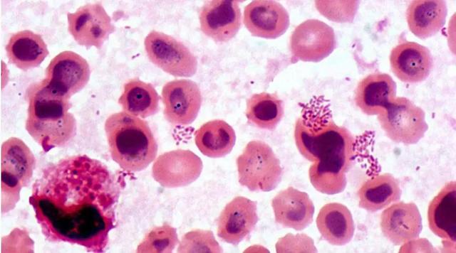 别喝现挤鲜羊奶了,小心感染致病菌,已有多人入院,最小的才3岁|细菌