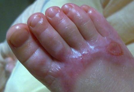 于是把盖在孩子身上的小被子用枕头压着,顺手把一旁的小太阳拿来靠近