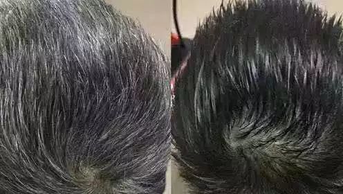 真的不是染发轻轻一点白发变黑发竟还有瑞士专利认证