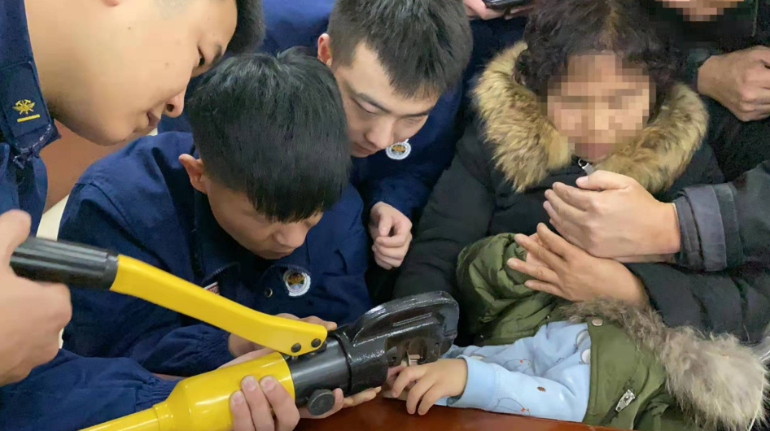 在操作过程中,孩子由于恐惧,时不时大声哭闹并拒绝切割.
