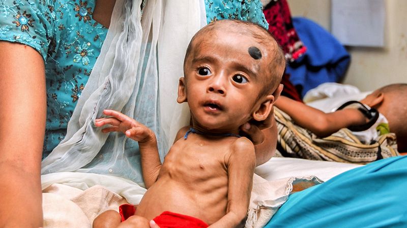 改善肠道微生物的补充剂有望改变孟加拉国儿童的营养状况。图片来源：美国《科学》杂志官网