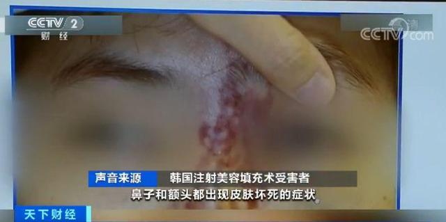 央视再曝韩国整容乱象 国人花5倍钱 中介抽1半（组图） - 1