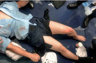 2019年8月11日，暴徒围攻尖沙咀警署，有警员双腿被烧伤。