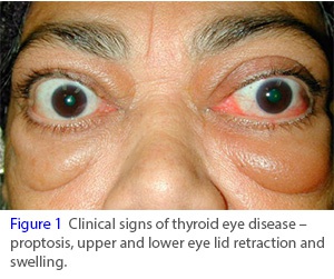 首个甲状腺眼病治疗药物!horizon公司igf-1r靶向单抗teprotumumab获美