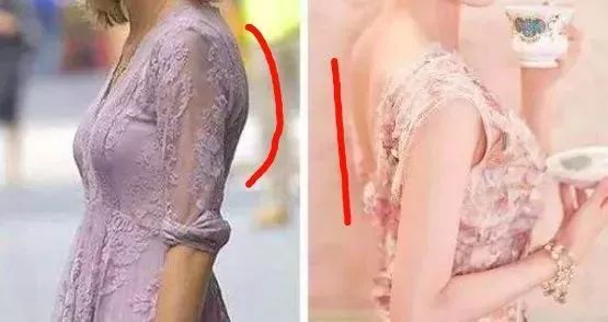 圆肩驼背毁气质1个简单动作就能缓解