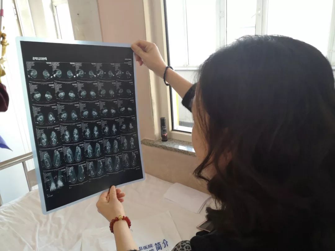 2019年1月21日，布病患者杨荣正在给记者展示她前不久刚拍的磁共振，脚踝周围有黑影。新京报记者吴靖 摄